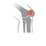 KNEE PAIN